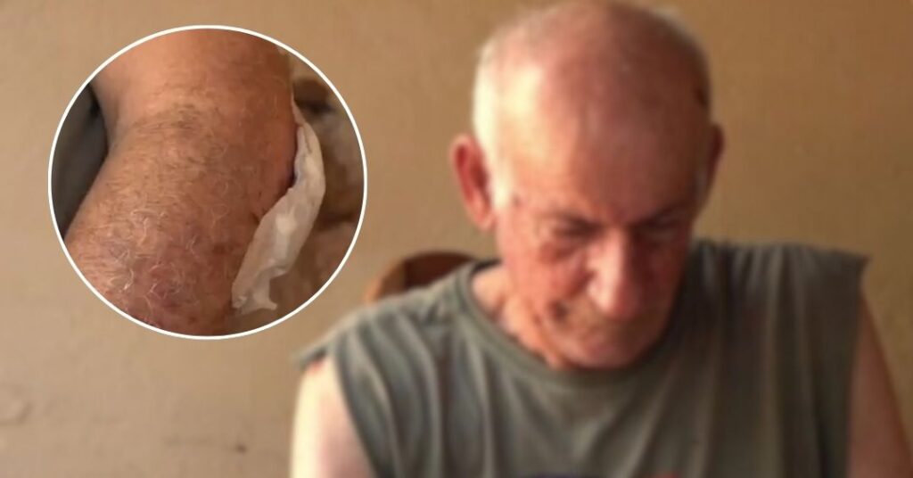 Conductor de motocarro atropelló a un adulto mayor y se dio a la fuga - C9N